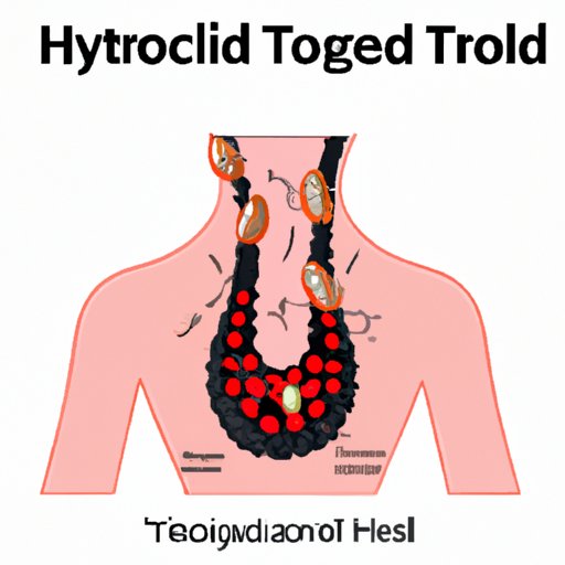 Thyroid Nodules: The Hidden Culprit of Stubborn Weight Gain