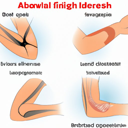 From Fractures to Dislocations: The Different Types of Elbow Injuries