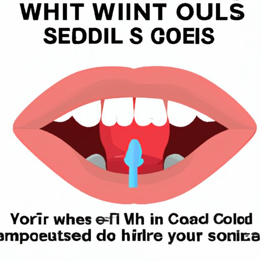 V. Why You Can Get Cold Sores Inside Your Mouth and How to Treat Them
