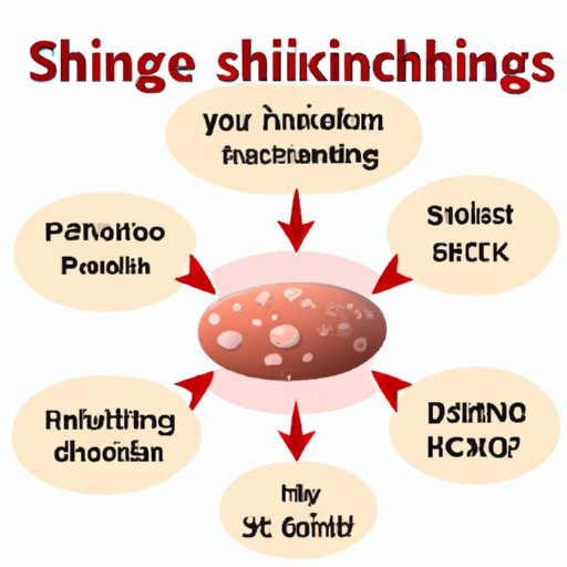 II. The Link Between Chickenpox and Shingles: What You Need to Know