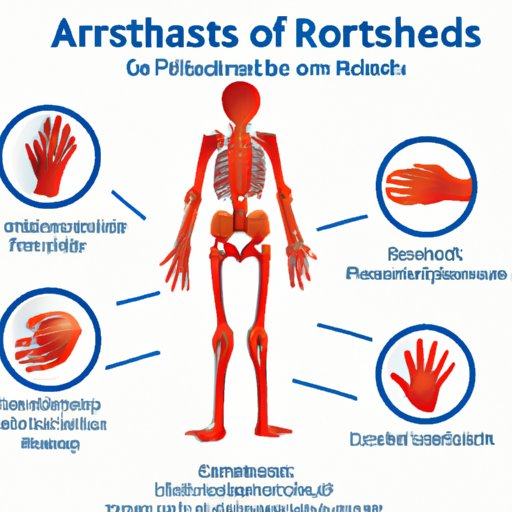 Understanding Psoriatic Arthritis Symptoms: A Comprehensive Guide