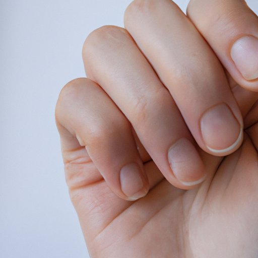 What Vitamin Deficiency Causes Dents in Fingernails The Importance of